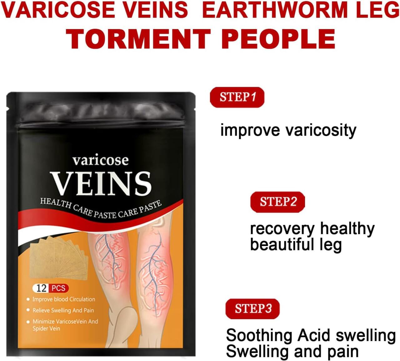 Varicose Veins