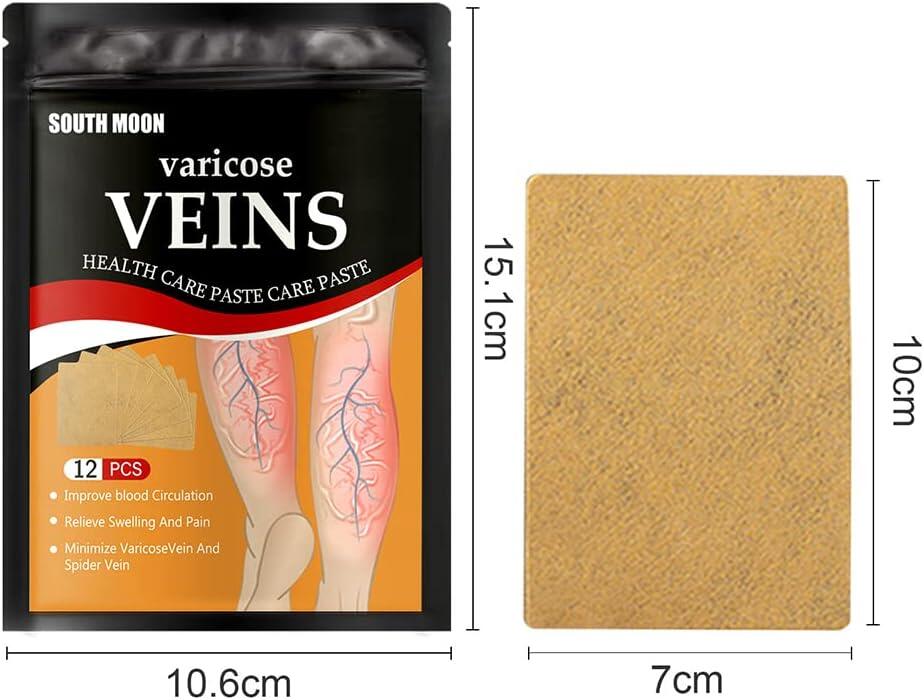 Varicose Veins