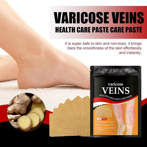 Varicose Veins